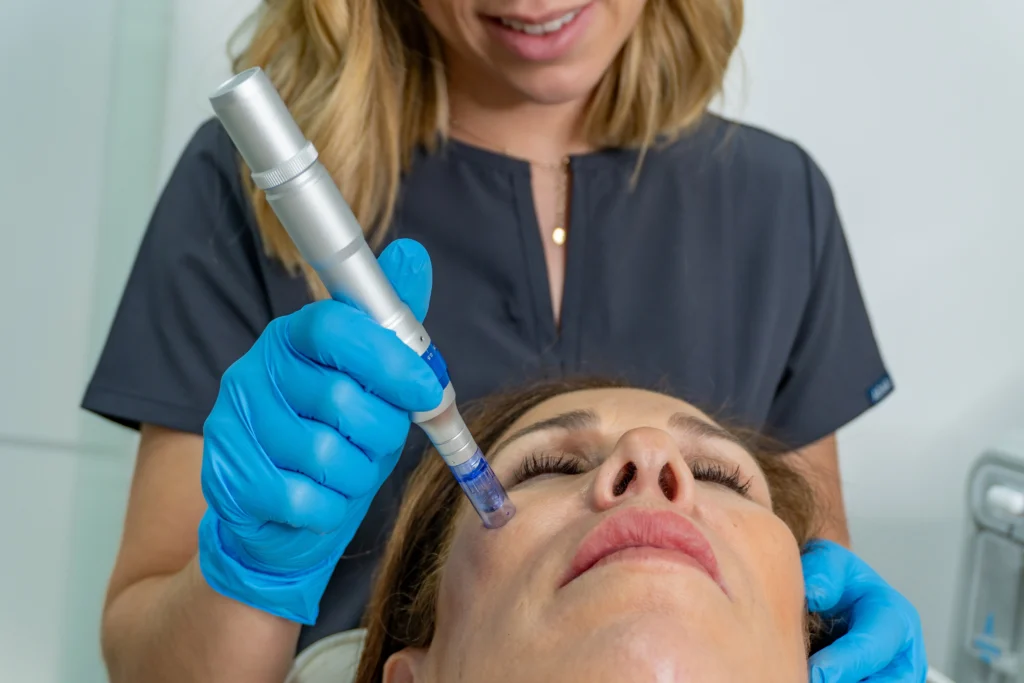 Esthetician giving skinpen microneedling treatment | The Steele Vault in Holladay, UT