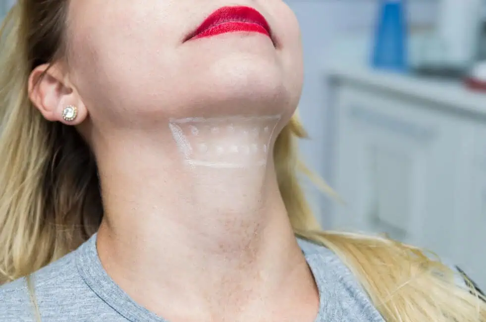 Kybella by The Steele Vault in Holladay, UT