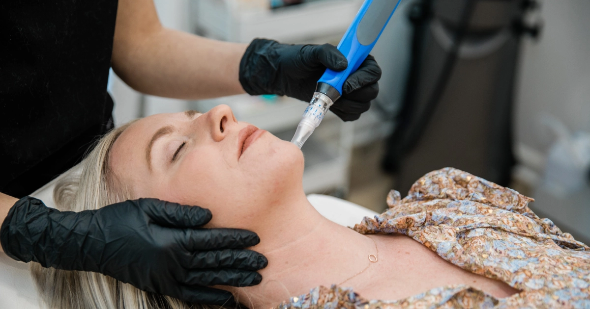 A blonde woman receiving SkinPen Microneedling treatment on her chin by a technician in Holladay, UT